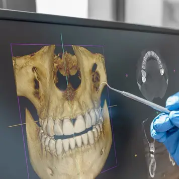 3D Tomografi