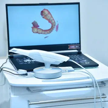 Ağız İçi Tarayıcı